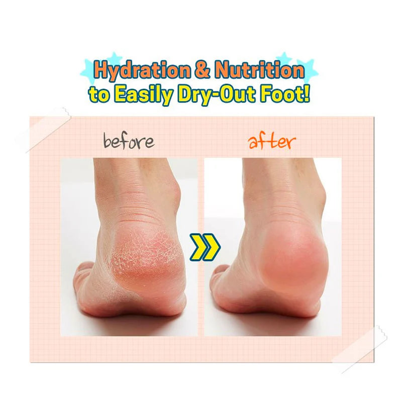 APIEU Soft Foot Peeling Socks šveičiamosios pėdų kojinės